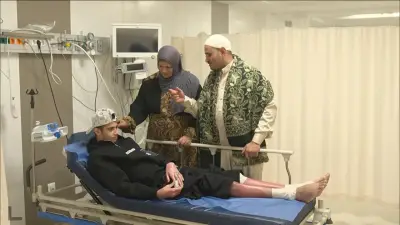 زراعة الجلد البشري: أمل جديد لمرضى الحروق في مصر ينقذ حياة المراهق إبراهيم