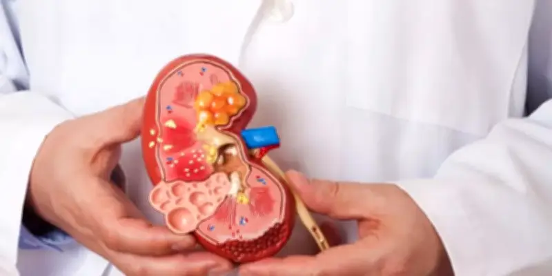 خبير كلوي يحذر: أمراض الكلى قد تتطور بصمت بعد سن الخمسين