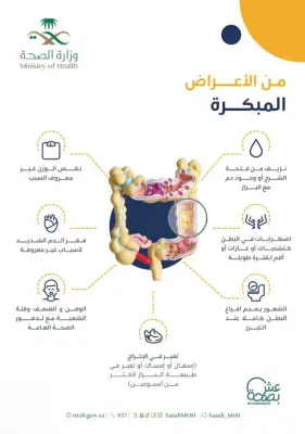 استشاري أورام: 90% من سرطانات القولون غير وراثية وضرورة الفحص بعد سن 45