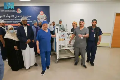 نجاح فصل التوأم الصومالي الملتصق بعد عملية جراحية معقدة في الرياض