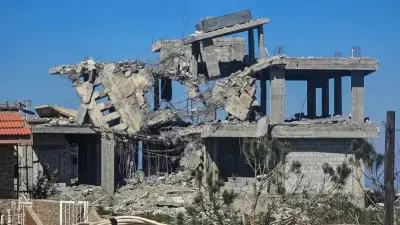 وزير الصحة السعودي يعلن عن إطلاق برنامج وطني شامل للصحة النفسية