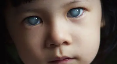 جلوكوما العين: الأسباب والأنواع والعلاج والفحص المبكر