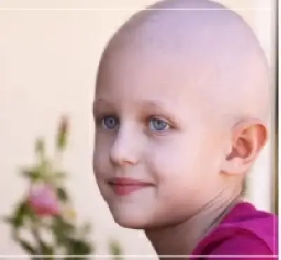 لغز «القطعة المفقودة».. لماذا يطارد السرطان الشباب رغم تراجع التدخين؟