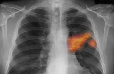 وزير التعليم يعلن عن إطلاق برنامج جديد لتحسين جودة التعليم في المدارس الحكومية