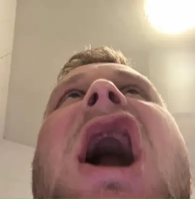 رحلة علاجية تتحول إلى كابوس: شاب بريطاني يفقد جميع أسنانه بعد تجربة سياحة علاجية في تركيا