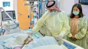 استقرار حالة التوأم الفلبيني بعد 7 أيام من عملية الفصل الناجحة