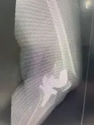 نجاح طبي بارز: مستشفى المانع – العزيزية يعيد قدرة المشي لمريضة مسنة بعد كسر معقد في الركبة