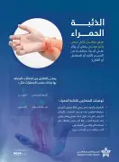 تجنب 4 محفزات رئيسية للذئبة الحمراء للتعايش مع المرض