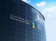 جامعة حائل تستجيب لطالبة وتؤجل حفل تخرجها لظرف عائلي