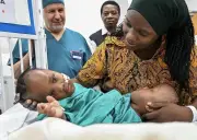لحظة إعلان نجاح فصل التوأم نانسي ونايس وفرحة الأم