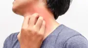 دراسة تكشف سبب كون حكة الوجه أشد ألماً من باقي الجسم
