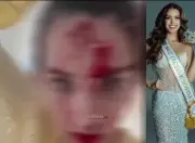 بالفيديو: الاعتداء على ملكة جمال فنزويلا داخل فندق بمهرجان