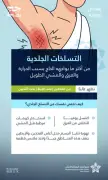 نصائح من تجمع الحدود الشمالية الصحي لتجنب التسلخات الجلدية للحجاج