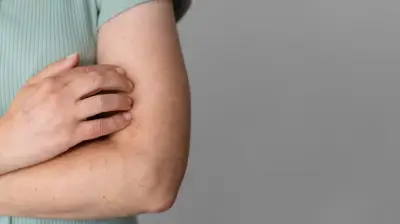 5 خطوات سهلة للوقاية من الطفح الجلدي الحراري في الصيف من وزارة الصحة