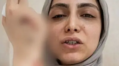 اعتداء على طبيبة أسنان في شبرا الخيمة.. كسر مضاعف وصراخ ودماء