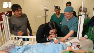 نجاح عملية فصل التوأم الملتصق الفلبيني بعد 6 ساعات في الرياض