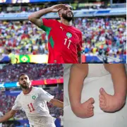 إسماعيل صيباري: من صعوبة المشي إلى نجومية مونديال 2026
