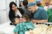 بدء عملية فصل التوأم الملتصق الفلبيني أوليفيا وجيانا بأمر ملكي