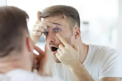 كيف تتخلص من احمرار العين ومتى يستدعي زيارة الطبيب؟