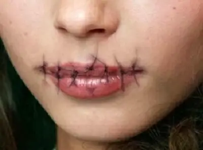 بإبرة وخيط.. يابانية تخيط شفتي جارتها لمنعها من الكلام
